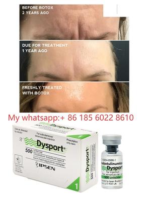 Tiêm Dysport 500IU Độc tố Botulinum Allergan Botulax - Làm mịn nếp nhăn và nếp nhăn