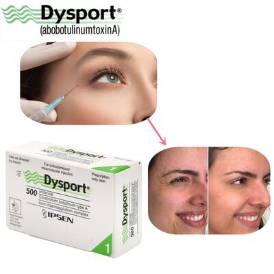 500u Dysport Xóa Nếp Nhăn Mặt Bột Đông Khô Gia Công Theo Yêu Cầu OEM Dysport